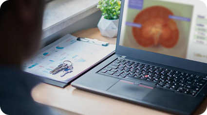 Ноутбук с изображением почки на экране